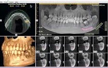 تنها دستگاه CBCT دندانی خراسان جنوبی در گمرک