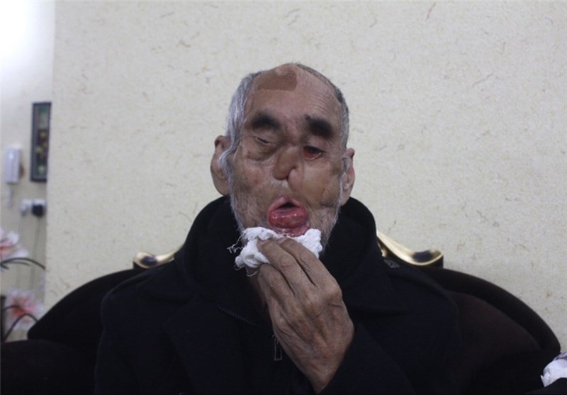 بستری شدن حاج رجب محمدزاده، جانباز مشهدی در بیمارستان