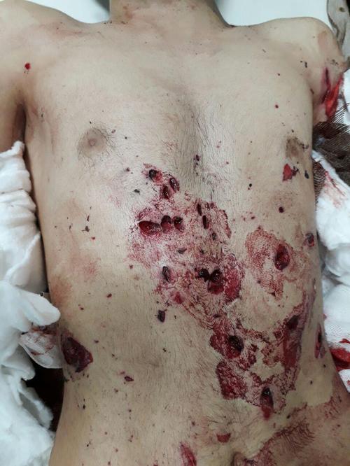 مصدومان حوادث چهارشنبه سوری استان یزد ۵۲نفر شدند + تصاویر