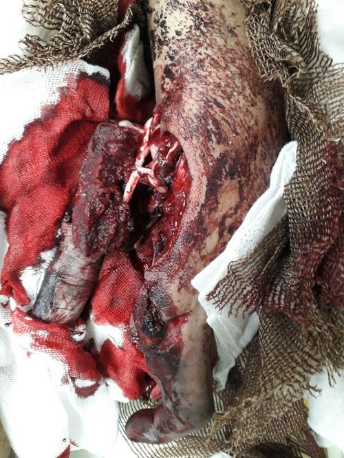 مصدومان حوادث چهارشنبه سوری استان یزد ۵۲نفر شدند + تصاویر