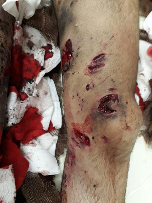 مصدومان حوادث چهارشنبه سوری استان یزد ۵۲نفر شدند + تصاویر