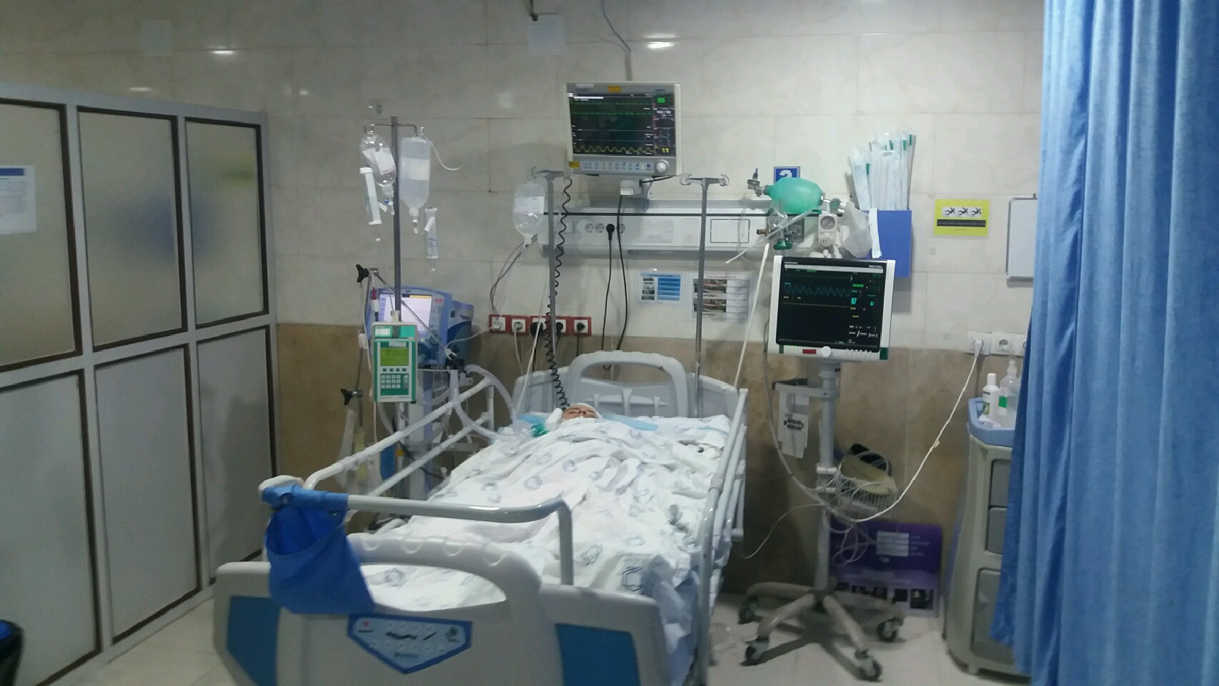 اهدا عضو بیمارمرگ مغزی در دوگنبدان