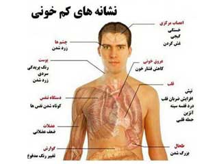 علائم فقر آهن