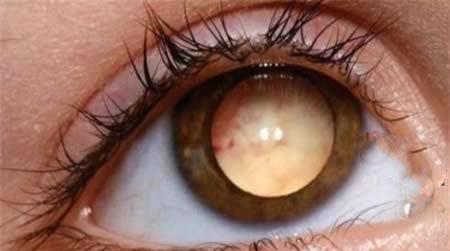 کدام افراد ترسناک‌ترین چشم‌ها را دارند؟