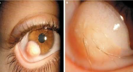 کدام افراد ترسناک‌ترین چشم‌ها را دارند؟