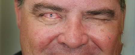 کدام افراد ترسناک‌ترین چشم‌ها را دارند؟