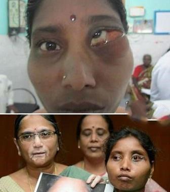 کدام افراد ترسناک‌ترین چشم‌ها را دارند؟