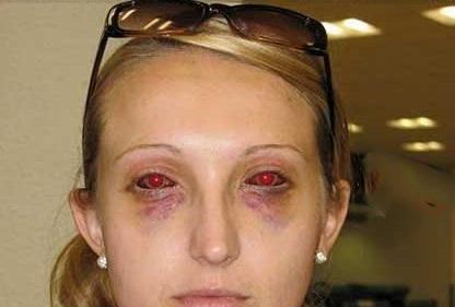 کدام افراد ترسناک‌ترین چشم‌ها را دارند؟