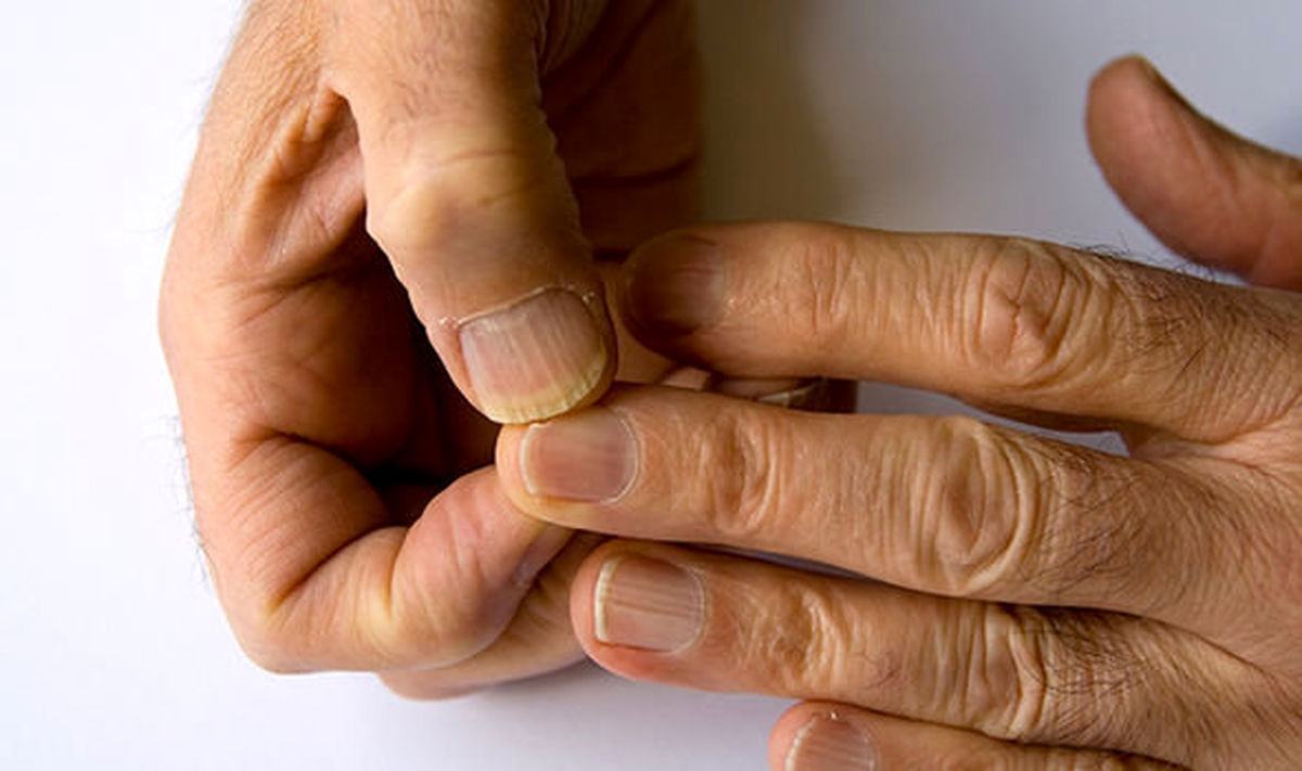 علائم دیابت نوع ۲