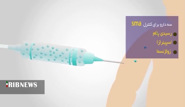 کودکان همدانی مبتلا به بیماری عضلانی نخاعی اس ام ای؛ در انتظار دریافت یکی از گران قیمت ترین داروهای جهان
