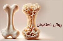 پویش ملی سلامت استخوان در گلستان